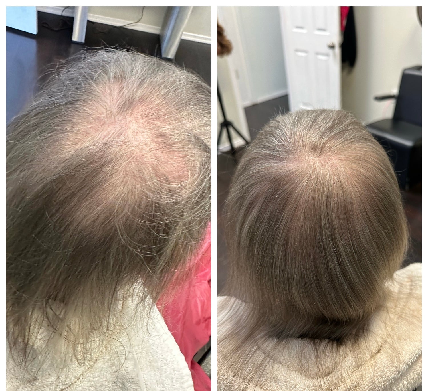 Before and after comparison of a person's hair 